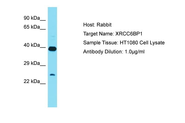Polyclonal Rabbit anti-Human XRCC6BP1 Antibody (C-Terminus, WB)