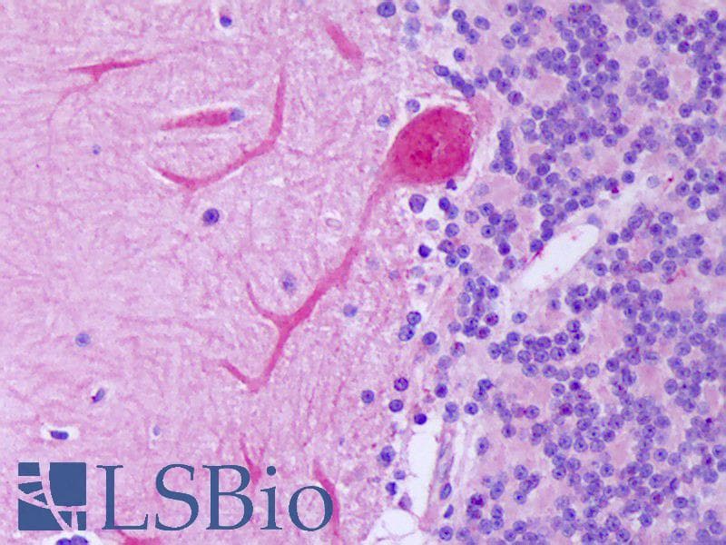 IHC-plus™ Polyclonal Rabbit anti-Human WNT1 Antibody (IHC, WB)