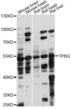 TPBG / 5T4 Antibody