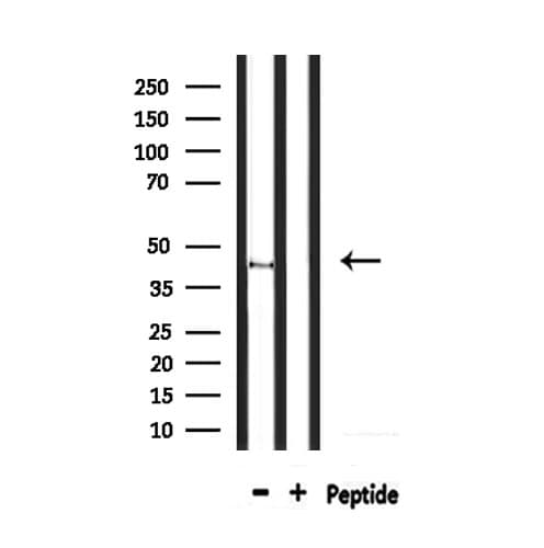 SREB / GPR85 Antibody