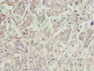 C1orf101 Antibody