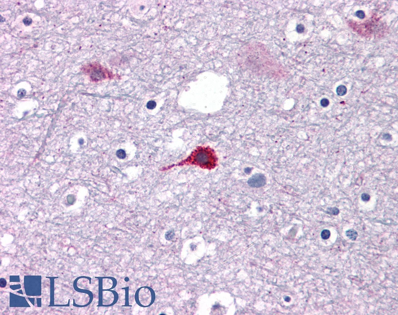 IHC-plus™ Polyclonal Rabbit anti-Human ZNF687 Antibody (IHC)