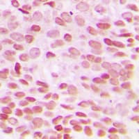 DDIT3 / CHOP Antibody (N-Terminus)