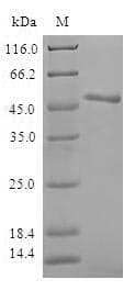 Human ANKRD54 / LIAR Protein (Recombinant GST, N-terminus)