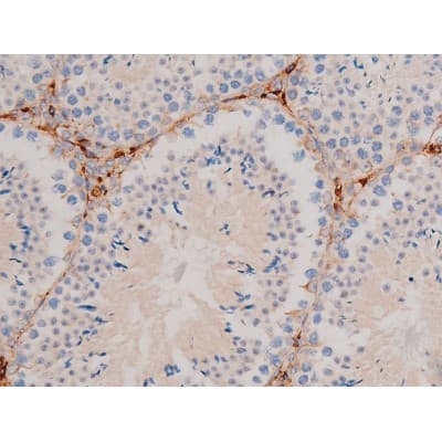 Polyclonal Rabbit anti-Human CDC25A Antibody (phospho-Ser124, IHC, IF, WB)