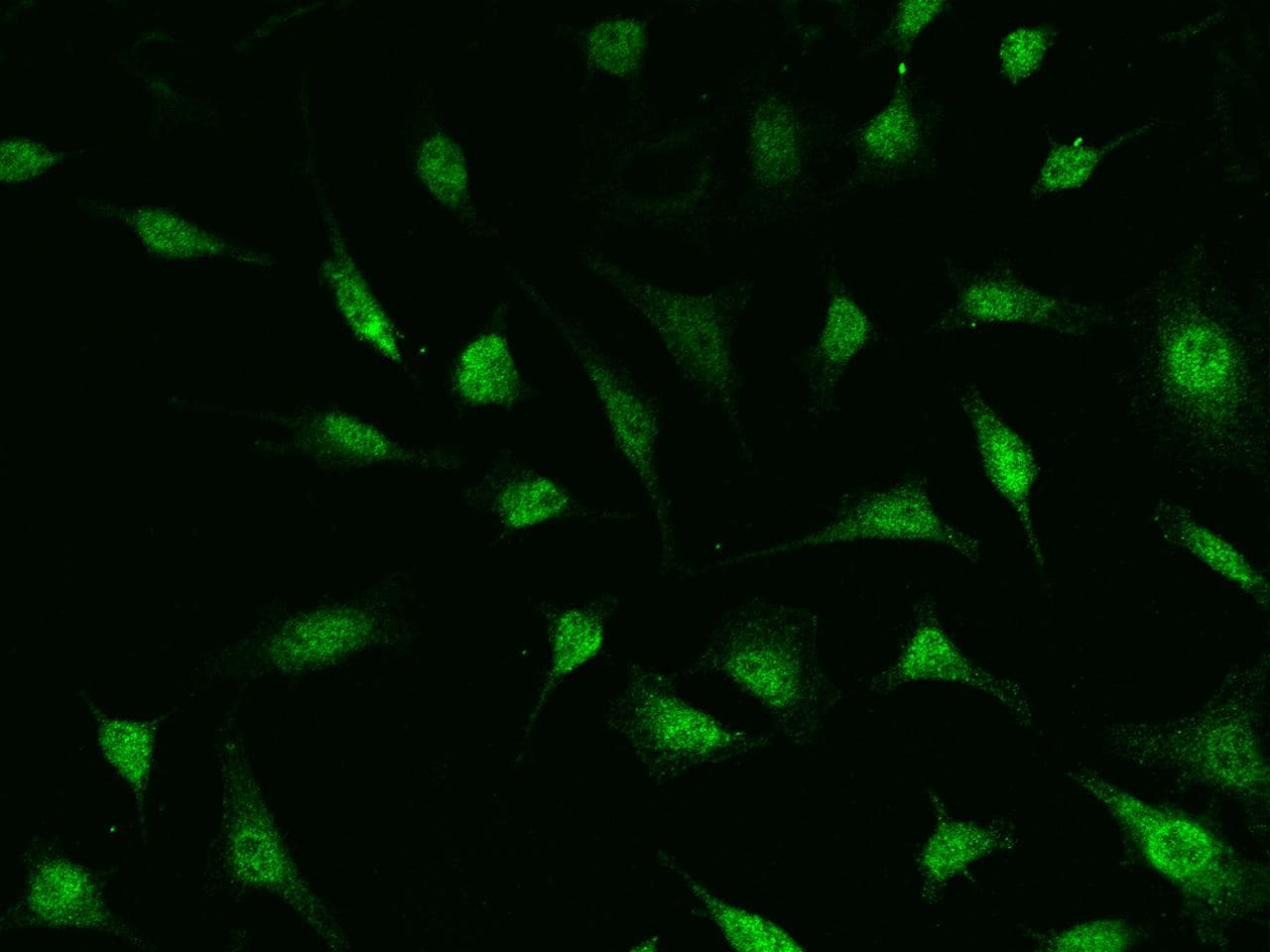 UBE2N / UBC13 Antibody