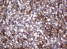 CD30 Antibody (clone OTI16H5)