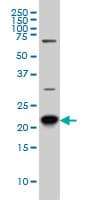 IHC-plus™ RAB8A / RAB8 Antibody (clone 3G1)