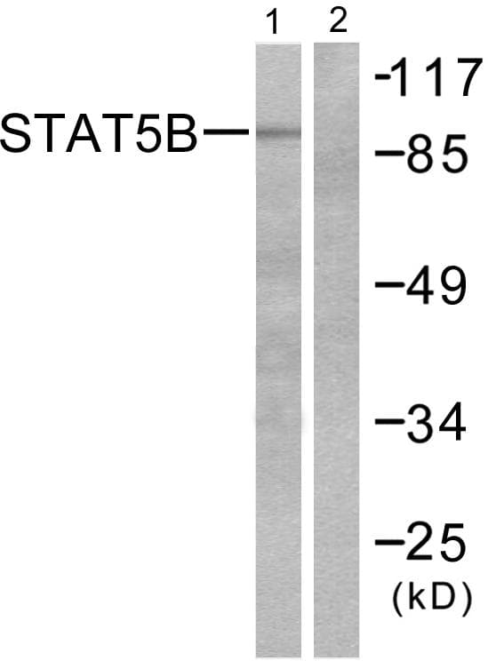 STAT5B Antibody (p731)