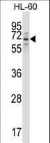 Polyclonal Rabbit anti-Human TRIM23 Antibody (aa147-175, IHC, WB)