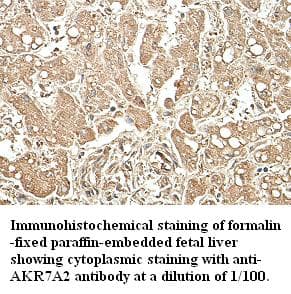 AKR7A2 / AFAR Antibody