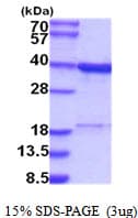 Human RPRD1B Protein (Recombinant His)