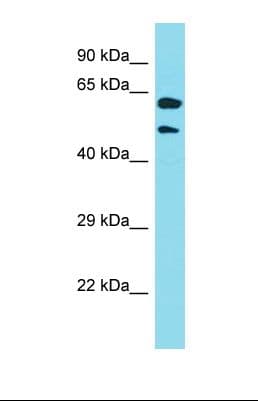 Polyclonal Rabbit anti-Human KRT39 / Cytokeratin 39 Antibody (aa75-124, WB)