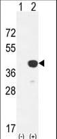 Polyclonal Rabbit anti-Human CTSK / Cathepsin K Antibody (aa207-237, IHC, WB)