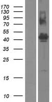 FAM187B Protein (Over-Expression Lysate Myc-DDK (Flag))
