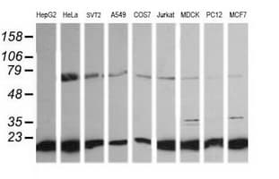 NDUFB10 Antibody (clone OTI2B4)