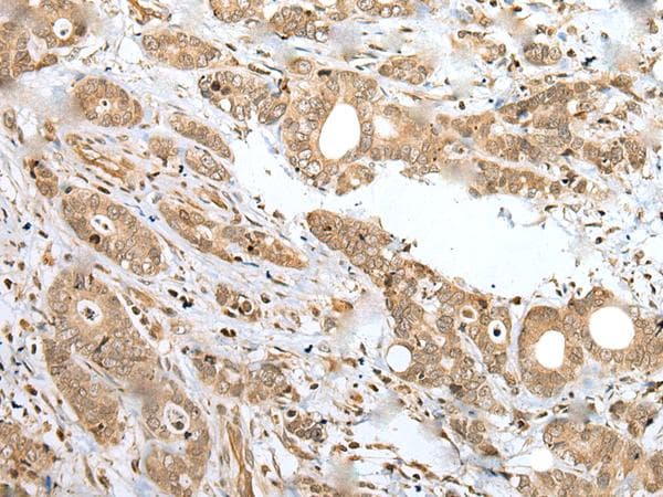 SPCS2 Antibody