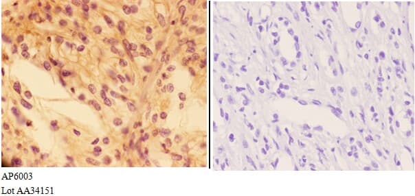 Polyclonal Rabbit anti-Human PTPRO Antibody (IHC, WB)