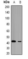 LETMD1 / HCCR1 Antibody