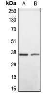 BNIP2 Antibody (C-Terminus)