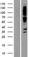 PPFIA1 / LIPRIN Protein (Over-Expression Lysate Myc-DDK (Flag))