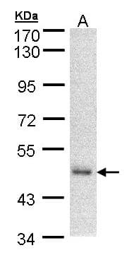 Polyclonal Rabbit anti-Human DNAJA2 Antibody (aa88-403, WB)