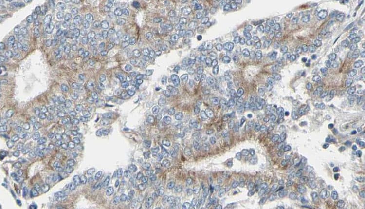 TUBGCP6 / GCP6 Antibody