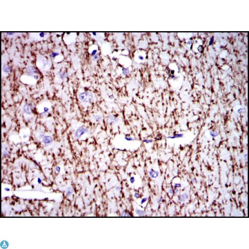 CD71 / Transferrin Receptor Antibody