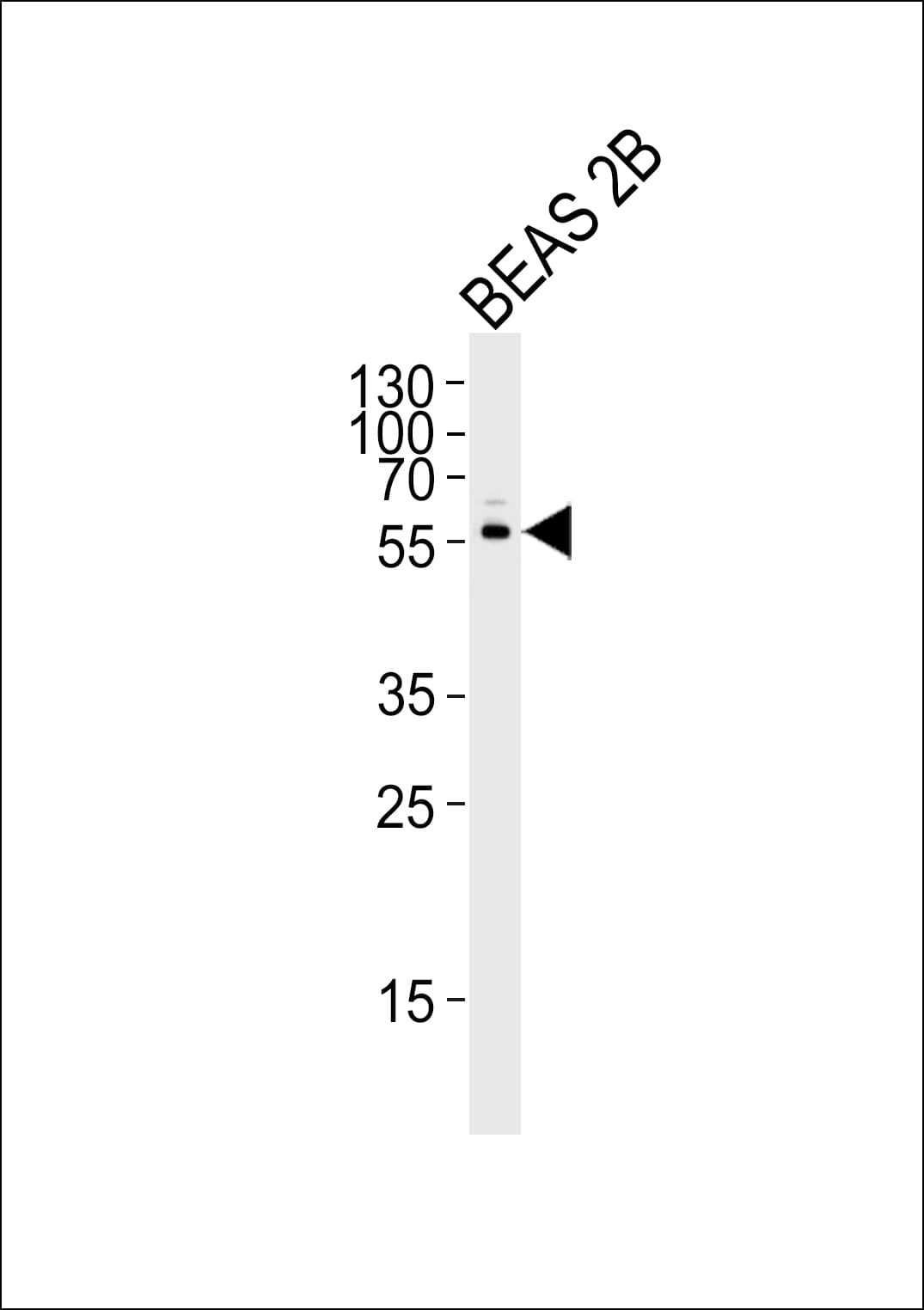 Polyclonal Rabbit anti-Human CYP2S1 Antibody (aa399-428, IHC, IF, WB)