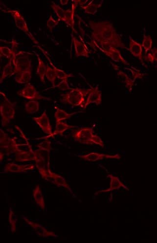 FZD2 / Frizzled 2 Antibody
