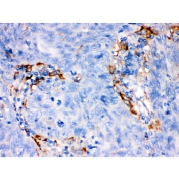 FCGRT / FCRN Antibody (aa56-291)