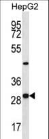 Polyclonal Rabbit anti-Human PROSC Antibody (aa232-260, WB)