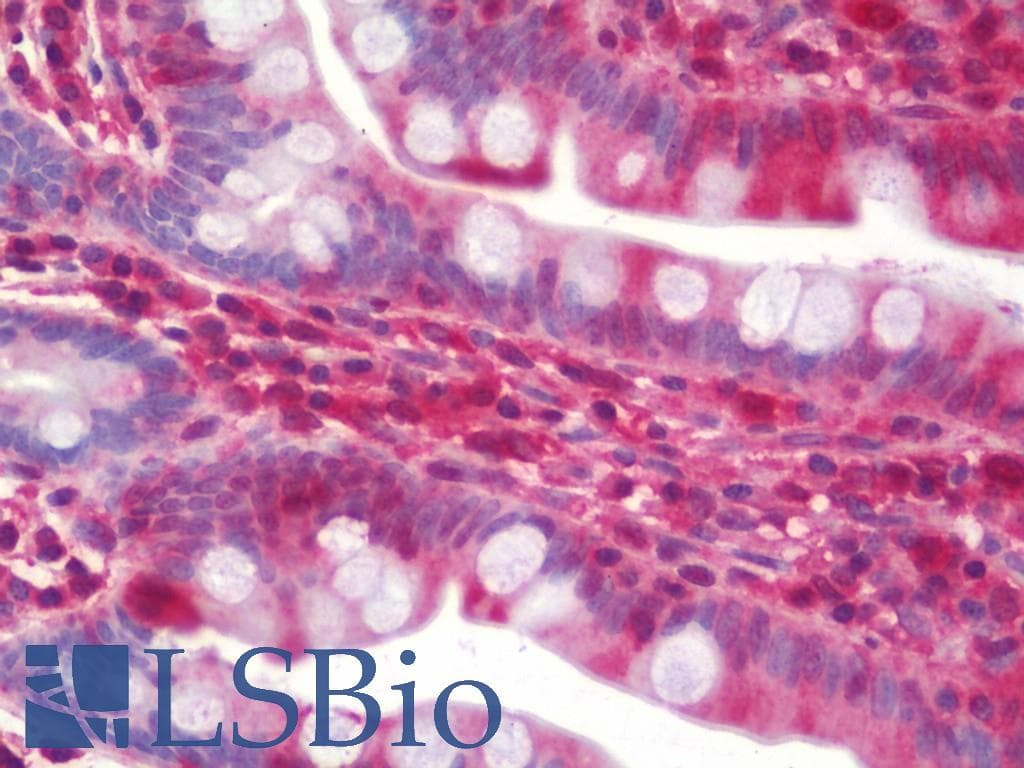 IHC-plus™ RAB8A / RAB8 Antibody (clone 3G1)