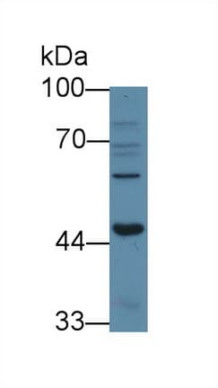 ACVR1B / ALK4 Antibody (aa24-126, Cy3)