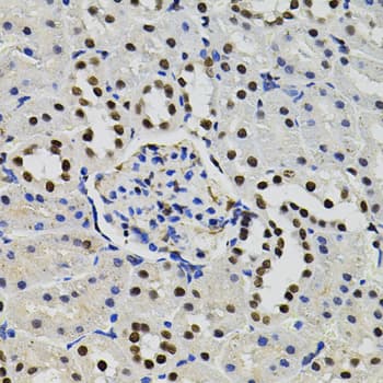 GTF2I / TFII I Antibody