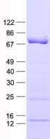 Human CCDC36 Protein (Recombinant His, N-Terminal)