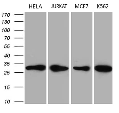 Monoclonal Mouse anti-Human PCMT1 Antibody (clone OTI4A4, aa60-285, IHC, WB)