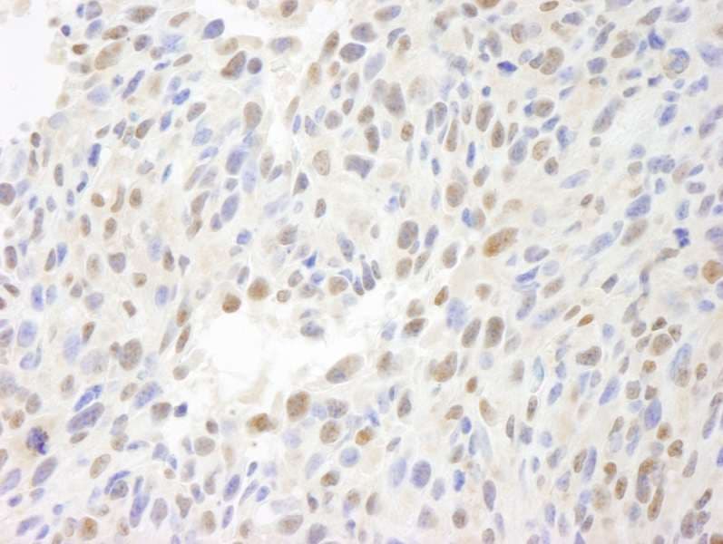 ATF7IP / MCAF1 Antibody (aa25-100)