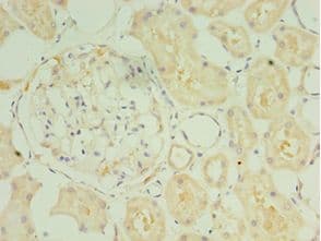 SULT1C2 / Sulfotransferase 1C2 Antibody (aa1-120)