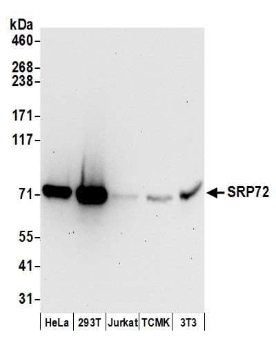 Polyclonal Rabbit anti-Human SRP72 Antibody (aa621-671, WB)