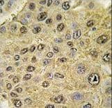 Polyclonal Rabbit anti-Human HIF1A / HIF1 Alpha Antibody (aa728-757, IHC, IF, WB)