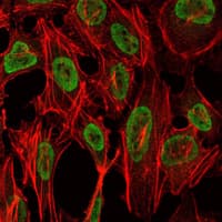 Monoclonal Mouse anti-Human PSIP1 / LEDGF Antibody (clone 6E4, IHC, IF, WB)