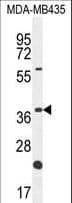 OR6V1 Antibody (aa242-270)