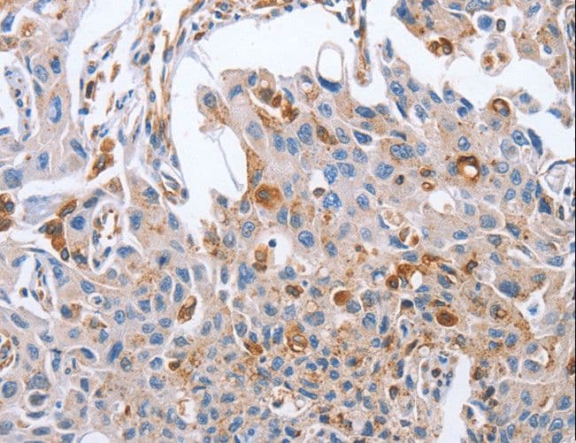 Polyclonal Rabbit anti-Human NRG4 Antibody (IHC)