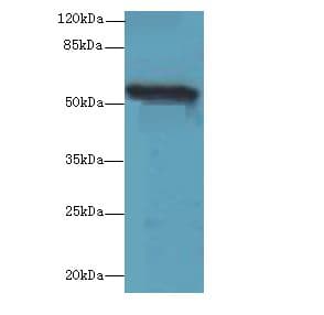 Polyclonal Rabbit anti-Human TMEM161A Antibody (IHC, WB)