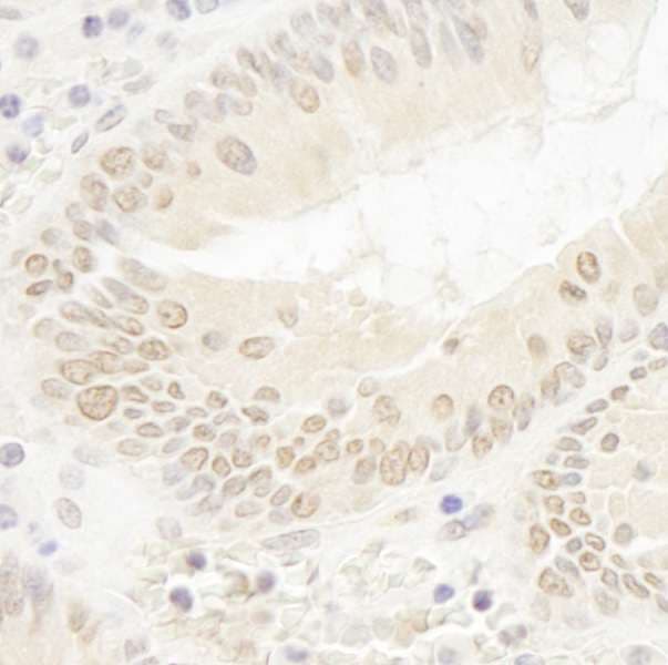 DOT1L / DOT1 Antibody (aa1000-1050)