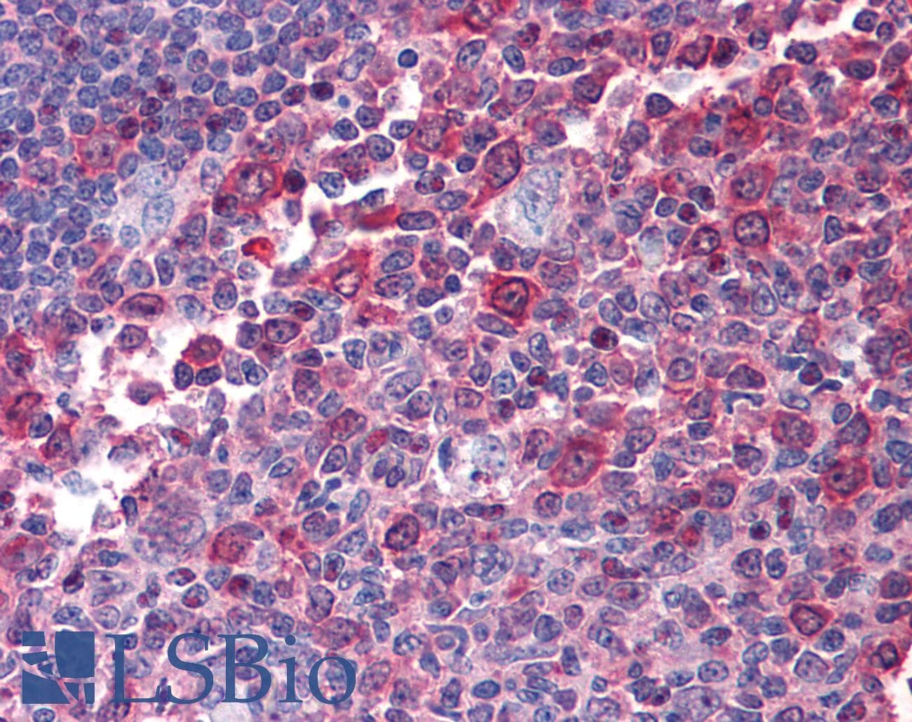 IHC-plus™ CYTH1 / Cytohesin-1 Antibody (clone 1D6)