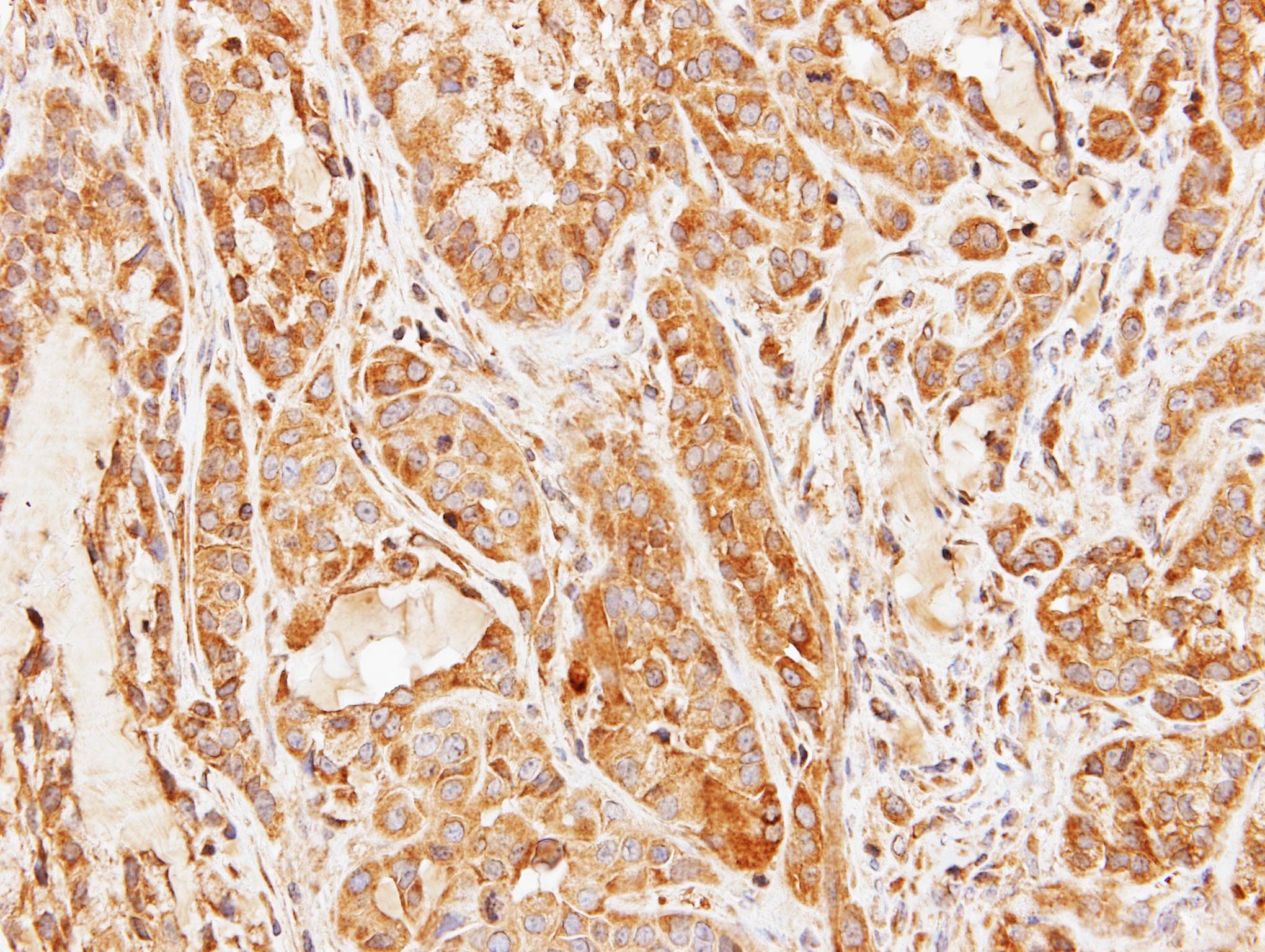Polyclonal Rabbit anti-Human CCDC83 Antibody (aa67-276, IHC, WB)