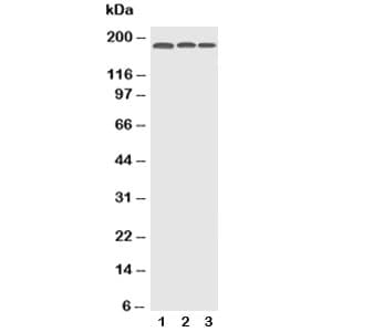 EGFR Antibody (aa25-346)