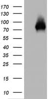 TP63 / p63 Antibody (clone OTI4E7)